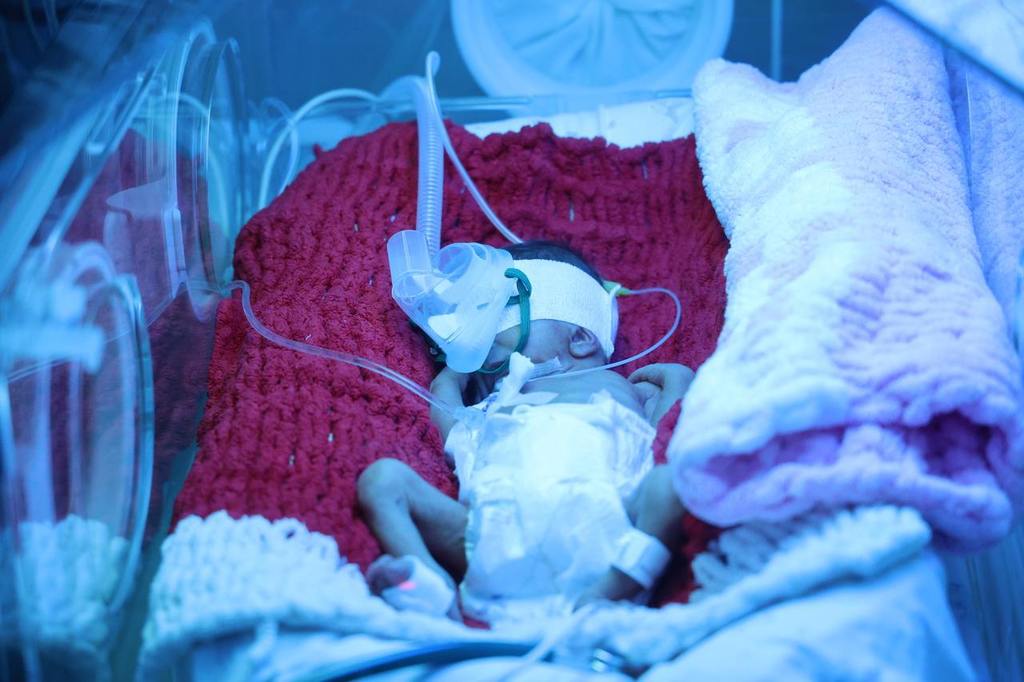 Врачи-неонатологи спасли жизни двум маловесным недоношенным мальчикам. Каждый весил менее килограмма